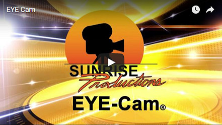 EYE-Cam Video